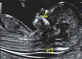 Ultrasound imaging at Sai Dhwani
