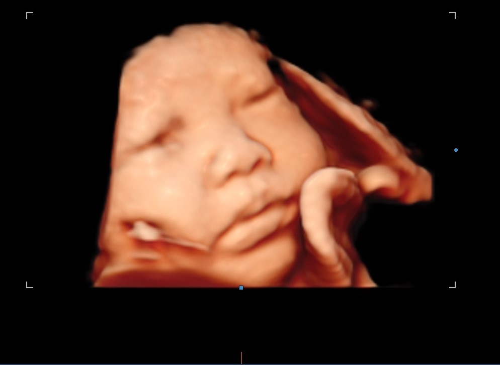 Diagnostic ultrasound setup at Sai Dhwani
